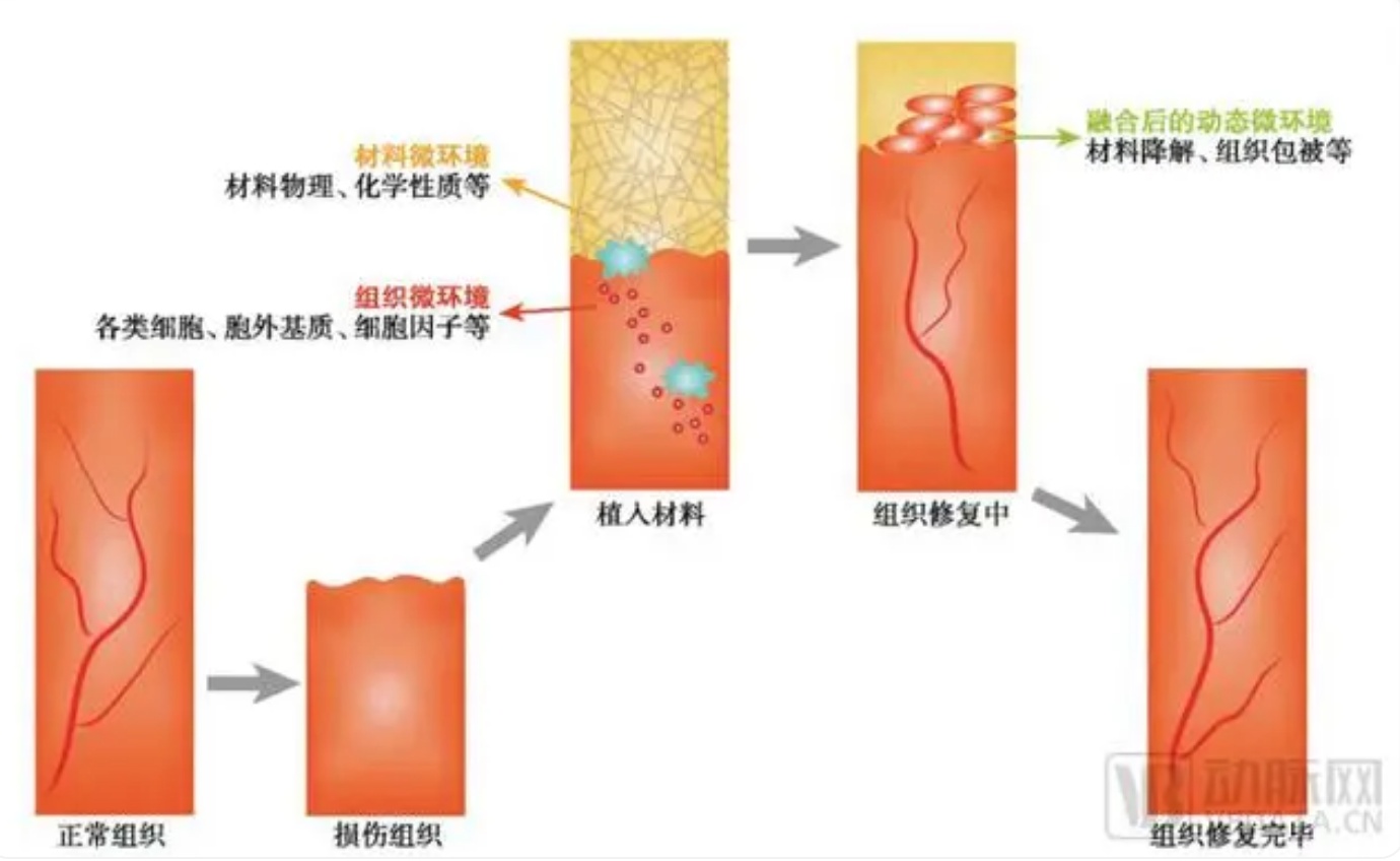 生物再生材料报告：骨科、创伤、医美三大细分领域引领创新